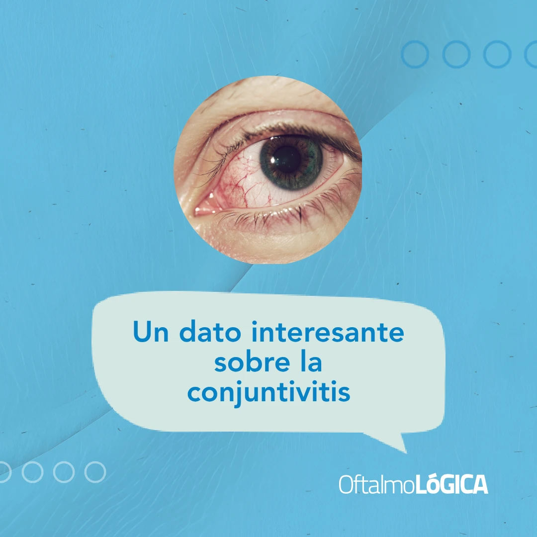 La conjuntivitis no es siempre contagiosa @ Oftalmológica - Centro Oftalmológico Integral, Santo Domingo, República Dominicana