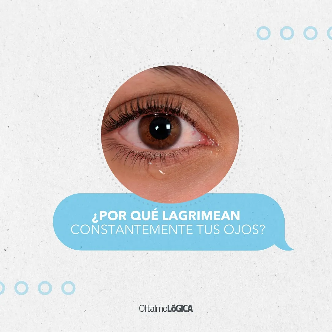 ¿Por qué lagrimean constantemente mis ojos? | Oftalmológica, Centro Oftalmológico Integral, Santo Domingo, República Dominicana