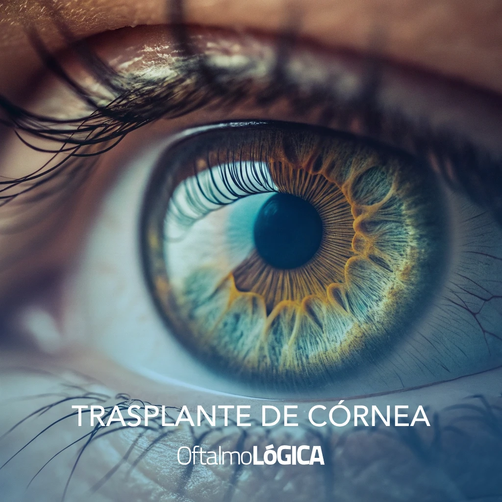 Trasplante de córnea en Santo Domingo — lo que debes saber @ Oftalmológica - Centro Oftalmológico Integral, Santo Domingo, República Dominicana