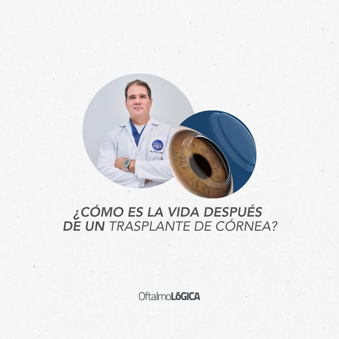 Cómo es la vida después de un trasplante de córnea, Dr. Mario Lovatón @ Oftalmológica - Centro Oftalmológico Integral, Santo Domingo, República Dominicana