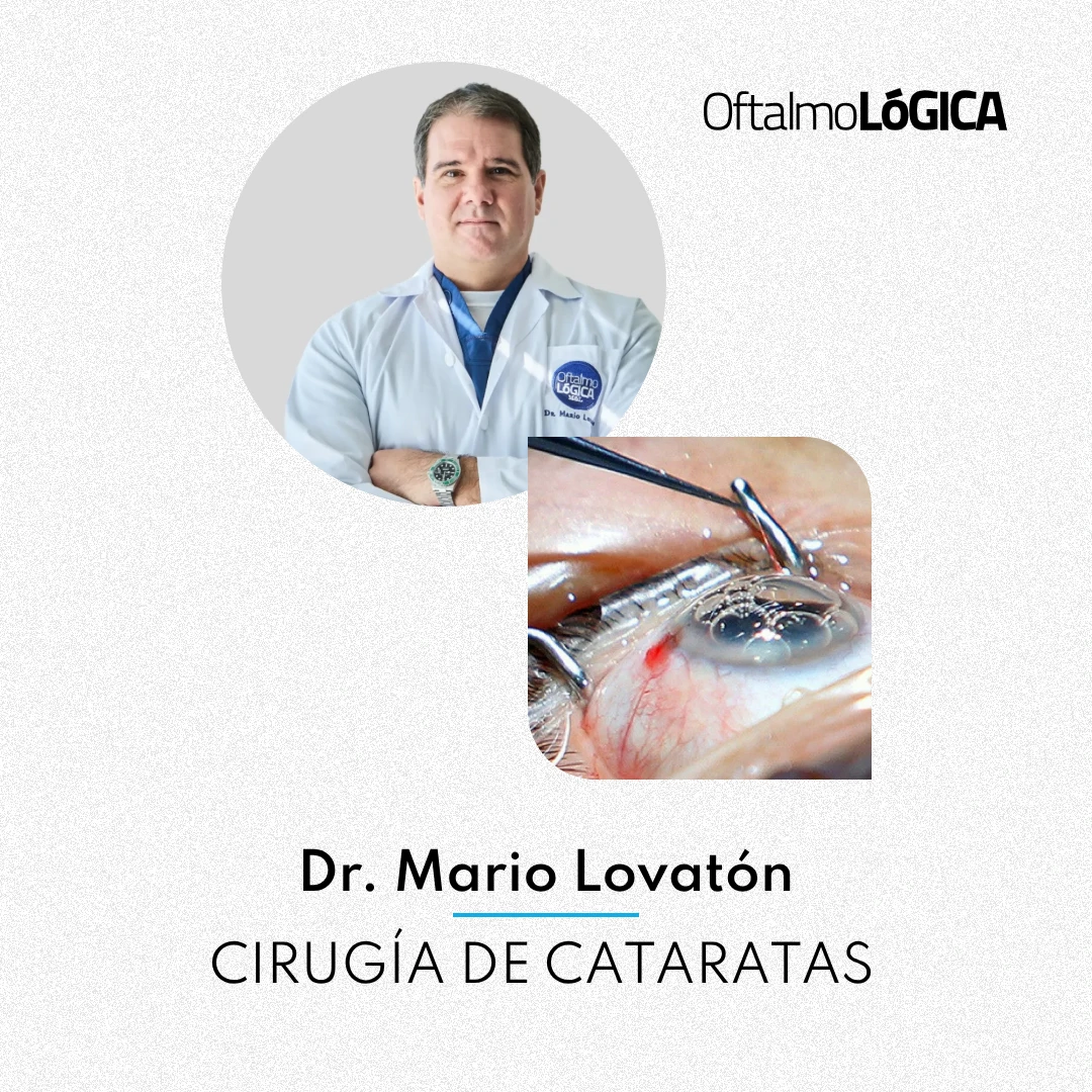 Cirugía de Cataratas con el Dr. Mario Lovatón R. @ Oftalmológica, Santo Domingo, República Dominicana
